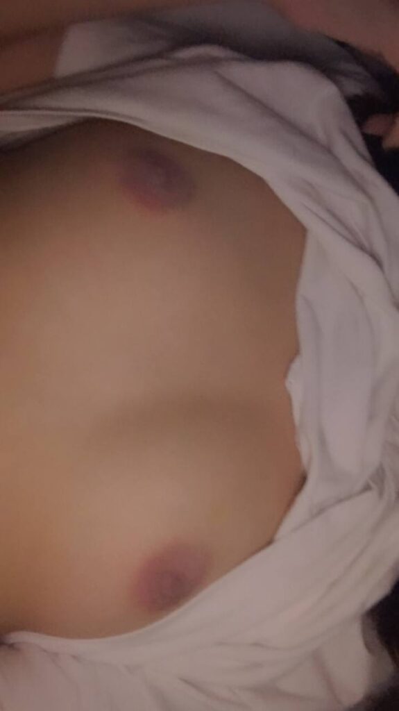 CA (1)